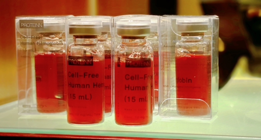 血浆供需关系紧张问题